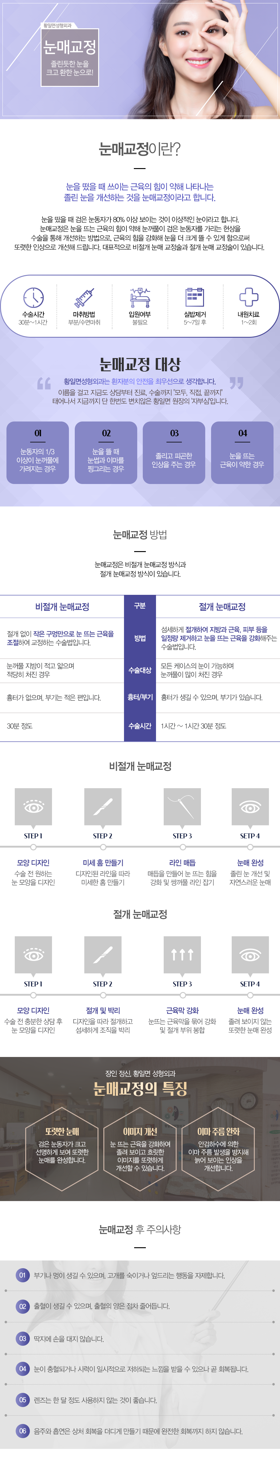 눈매성형